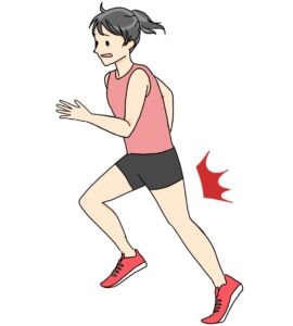 肉離れ